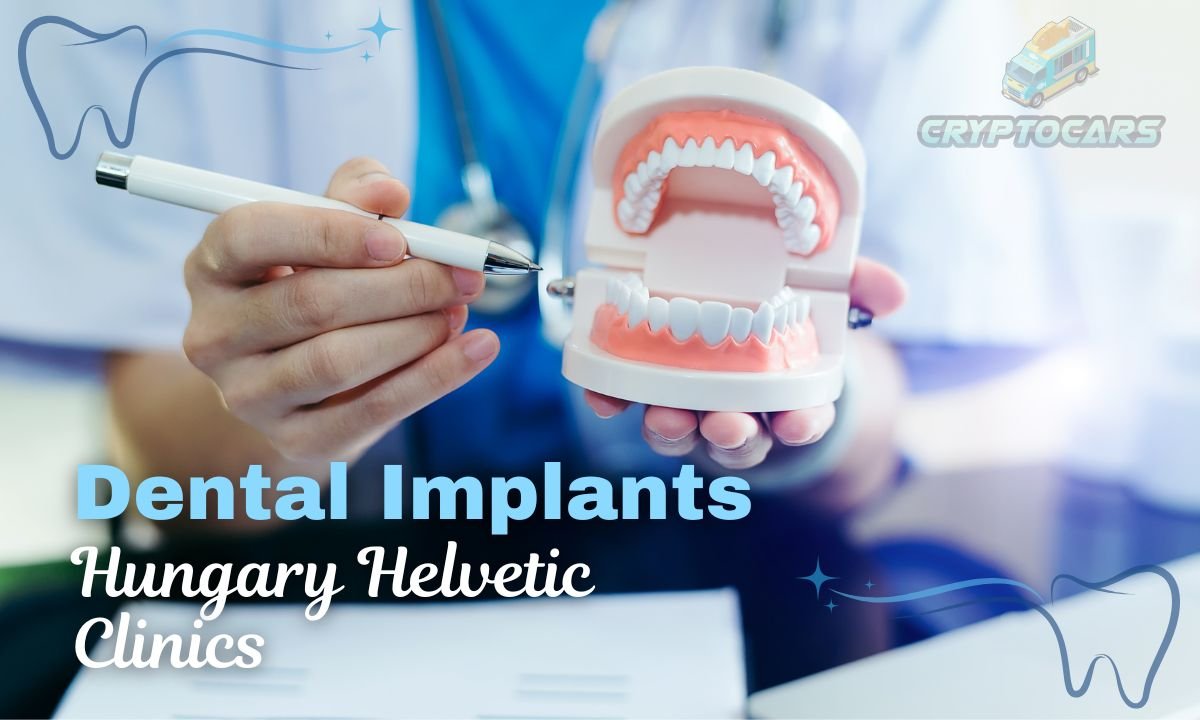 Dental Implants Hungary Helvetic Clinics